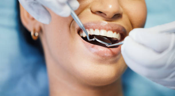 Best Chipped Tooth Repair Near Me  in Newton, KS